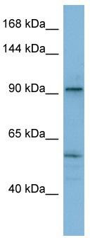 WB Suggested Anti-ATP2A1 Antibody Titration: 0.2-1 ug/ml; ELISA Titer: 1: 62500; Positive Control: THP-1 cell lysate