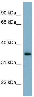 WB Suggested Anti-GEM Antibody Titration: 0.2-1 ug/ml; ELISA Titer: 1: 62500; Positive Control: OVCAR-3 cell lysate
