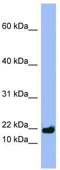 WB Suggested Anti-SPRR3 Antibody Titration: 0.2-1 ug/ml; ELISA Titer: 1: 312500; Positive Control: NCI-H226 cell lysate