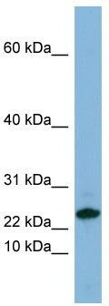 WB Suggested Anti-SPRR3 Antibody Titration: 0.2-1 ug/ml; ELISA Titer: 1: 62500; Positive Control: HT1080 cell lysate