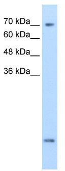 WB Suggested Anti-SLC6A8 Antibody Titration: 2.5 ug/ml; Positive Control: MDA-MB-435S cell lysate; SLC6A8 is strongly supported by BioGPS gene expression data to be expressed in Human MDA-MB435 cells