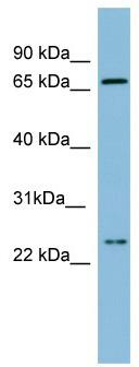 WB Suggested Anti-SLC6A8 Antibody Titration: 0.2-1 ug/ml; ELISA Titer: 1: 312500; Positive Control: Human Small Intestine