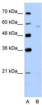 WB Suggested Anti-SLC22A7 Antibody Titration: 5.0 ug/ml; Positive Control: Jurkat cell lysate; There is BioGPS gene expression data showing that SLC22A7 is expressed in Jurkat
