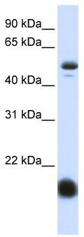 WB Suggested Anti-SLC22A7 Antibody Titration: 0.2-1 ug/ml; ELISA Titer: 1: 62500; Positive Control: Human Liver