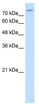 WB Suggested Anti-SLC20A2 Antibody Titration: 0.2-1 ug/ml; Positive Control: HepG2 cell lysate