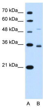 WB Suggested Anti-SLC38A3 Antibody Titration: 0.2-1 ug/ml; Positive Control: HepG2 cell lysate; SLC38A3 is supported by BioGPS gene expression data to be expressed in HepG2