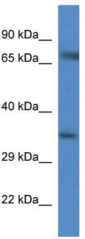WB Suggested Anti-Slc6a9 Antibody; Titration: 1.0 ug/ml; Positive Control: Mouse Spleen