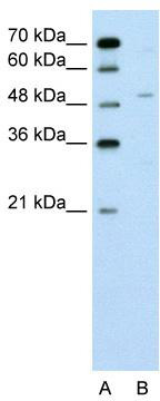 WB Suggested Anti-ZNF19 Antibody Titration: 0.2-1 ug/ml; Positive Control: Jurkat cell lysate