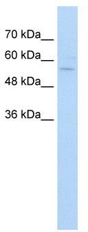 WB Suggested Anti-ZNF19 Antibody Titration: 5.0 ug/ml; Positive Control: Jurkat cell lysate