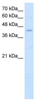 WB Suggested Anti-FADS1 Antibody Titration: 2.5 ug/ml; Positive Control: K562 cell lysate; FADS1 is strongly supported by BioGPS gene expression data to be expressed in Human K562 cells