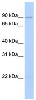 WB Suggested Anti-TMCC2 Antibody Titration: 0.2-1 ug/ml; ELISA Titer: 1: 312500; Positive Control: Hela cell lysate