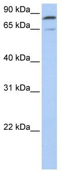WB Suggested Anti-MFN2 Antibody Titration: 0.2-1 ug/ml; Positive Control: 293T cell lysate