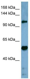 WB Suggested Anti-COBLL1 Antibody Titration: 0.2-1 ug/ml; ELISA Titer: 1: 312500; Positive Control: Human Stomach