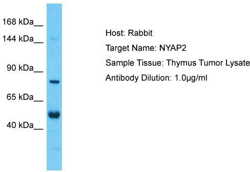 Host: Rabbit; Target Name: NYAP2; Sample Tissue: Thymus Tumor lysates; Antibody Dilution: 1.0 ug/ml