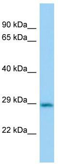 Host: Rabbit; Target Name: Cbr2; Sample Tissue: Mouse Lung lysates; Antibody Dilution: 1.0 ug/ml
