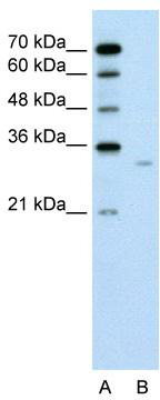 WB Suggested Anti-DCXR Antibody Titration: 0.2-1 ug/ml; Positive Control: Jurkat cell lysate
