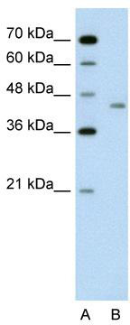 WB Suggested Anti-LRP2BP Antibody Titration: 0.2-1 ug/ml; Positive Control: Jurkat cell lysate