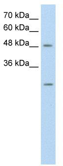 WB Suggested Anti-ANKRD2 Antibody Titration: 0.2-1 ug/ml; Positive Control: HepG2 cell lysate