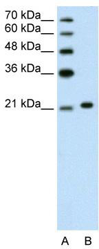 WB Suggested Anti-ANK1 Antibody Titration: 1.25 ug/ml; Positive Control: Jurkat cell lysate