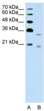 WB Suggested Anti-DNASE2B Antibody Titration: 1.25 ug/ml; Positive Control: Jurkat cell lysate