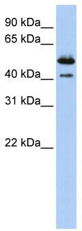 WB Suggested Anti-DNASE2B Antibody Titration: 0.2-1 ug/ml; ELISA Titer: 1:312500; Positive Control: Human Placenta
