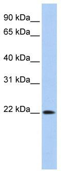 WB Suggested Anti-DNASE2B Antibody Titration: 0.2-1 ug/ml; ELISA Titer: 1:312500; Positive Control: 293T cell lysate