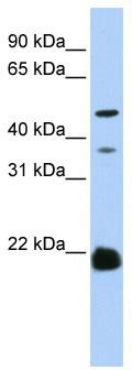 WB Suggested Anti-ZDHHC14 Antibody Titration: 0.2-1 ug/ml; ELISA Titer: 1:1562500; Positive Control: Hela cell lysate
