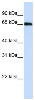WB Suggested Anti-WDR23 Antibody Titration: 0.2-1 ug/ml; ELISA Titer: 1:312500; Positive Control: Human Placenta