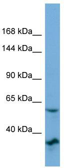 Host: Rabbit; Target Name: OSBP2; Sample Tissue: OVCAR-3 Whole cell lysates; Antibody Dilution: 1.0ug/ml