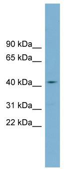 WB Suggested Anti-ZDHHC18 Antibody Titration: 0.2-1 ug/ml; Positive Control: OVCAR-3 cell lysateZDHHC18 is supported by BioGPS gene expression data to be expressed in OVCAR3
