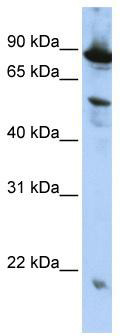 Host: Rabbit Target Name: NOX1 Sample Tissue: U937 Whole Cell lysates Antibody Dilution: 1ug/ml