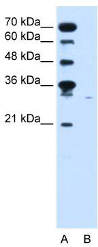 WB Suggested Anti-SLC22A7 Antibody Titration: 0.2-1 ug/ml; Positive Control: Jurkat cell lysateThere is BioGPS gene expression data showing that SLC22A7 is expressed in Jurkat