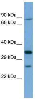 Host: Rabbit; Target Name: SLC6A9; Sample Tissue: THP-1 Whole cell lysates; Antibody Dilution: 1.0ug/ml