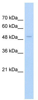 WB Suggested Anti-FAM174B Antibody Titration: 2.5 ug/ml; Positive Control: Jurkat cell lysate
