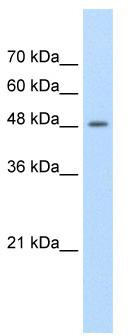 WB Suggested Anti-FAM174B Antibody Titration: 1.25 ug/ml; Positive Control: Jurkat cell lysate