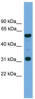 WB Suggested Anti-Gja10 Antibody Titration: 0.2-1 ug/ml; Positive Control: Mouse Heart