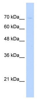 WB Suggested Anti-KIAA1333 Antibody Titration: 0.2-1 ug/ml; Positive Control: HepG2 cell lysate