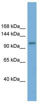 WB Suggested Anti-HERC6 Antibody Titration: 0.2-1 ug/ml; Positive Control: ACHN cell lysate