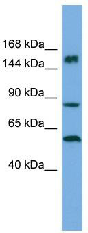 Host: Rabbit; Target Name: HERC3; Sample Tissue: ACHN Whole Cell lysates; Antibody Dilution: 1.0ug/ml