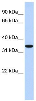 WB Suggested Anti-MARCH1 Antibody Titration: 0.2-1 ug/ml; ELISA Titer: 1:1562500; Positive Control: Human Muscle
