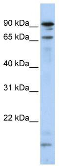 WB Suggested Anti-MSL2L1 Antibody Titration: 0.2-1 ug/ml; ELISA Titer: 1:1562500; Positive Control: Hela cell lysate