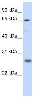 WB Suggested Anti-RNF186 Antibody Titration: 0.2-1 ug/ml; ELISA Titer: 1:312500; Positive Control: Transfected 293T