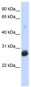 WB Suggested Anti-RNF186 Antibody Titration: 0.2-1 ug/ml; ELISA Titer: 1:62500; Positive Control: Transfected 293T