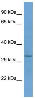 Host: Rabbit; Target Name: RNF150; Sample Tissue: Jurkat Whole cell lysates; Antibody Dilution: 1.0ug/ml