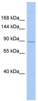 WB Suggested Anti-SH3RF1 Antibody Titration: 0.2-1 ug/ml; ELISA Titer: 1:312500; Positive Control: DU145 cell lysate
