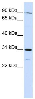 WB Suggested Anti-LONRF3 Antibody Titration: 0.2-1 ug/ml; ELISA Titer: 1:312500; Positive Control: Human Liver