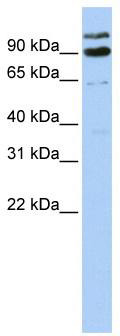 WB Suggested Anti-LONRF3 Antibody Titration: 0.2-1 ug/ml; ELISA Titer: 1:312500; Positive Control: 293T cell lysate