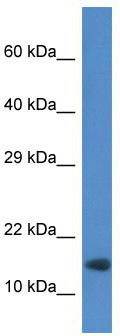 WB Suggested Anti-Rnf122 Antibody; Titration: 1.0 ug/ml; Positive Control: Mouse Heart