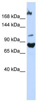 WB Suggested Anti-FBXO11 Antibody Titration: 0.2-1 ug/ml; ELISA Titer: 1:62500; Positive Control: 293T cell lysateFBXO11 is strongly supported by BioGPS gene expression data to be expressed in Human HEK293T cells