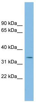 WB Suggested Anti-PCGF6 Antibody Titration: 0.2-1 ug/ml; ELISA Titer: 1:62500; Positive Control: NCI-H226 cell lysate